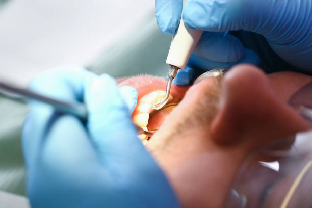 Best Broken or Cracked Tooth Emergency Dentist in Pea Ridge, WV